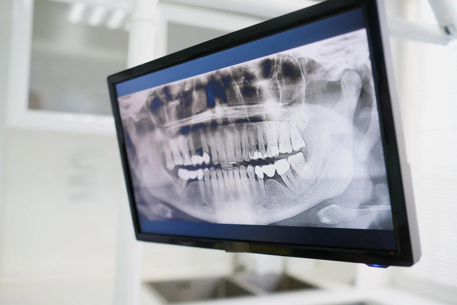 Panoramic dental radiograph displayed on a clinic monitor for independent review