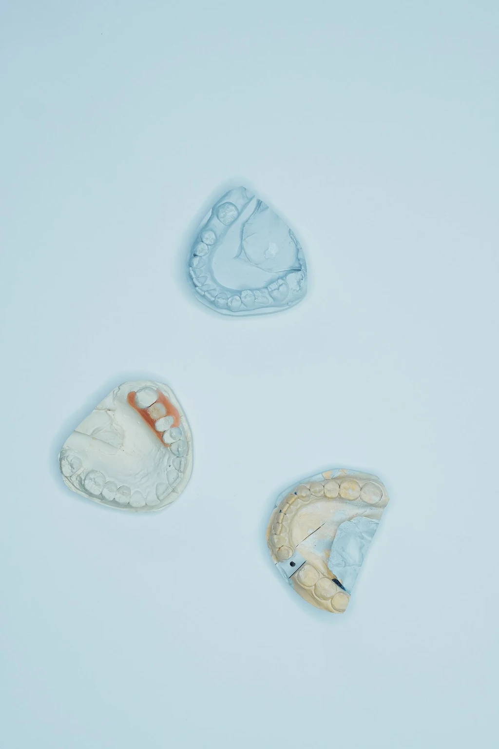 Dental records and a study model prepared to establish which teeth were damaged and whether the damage is permanent