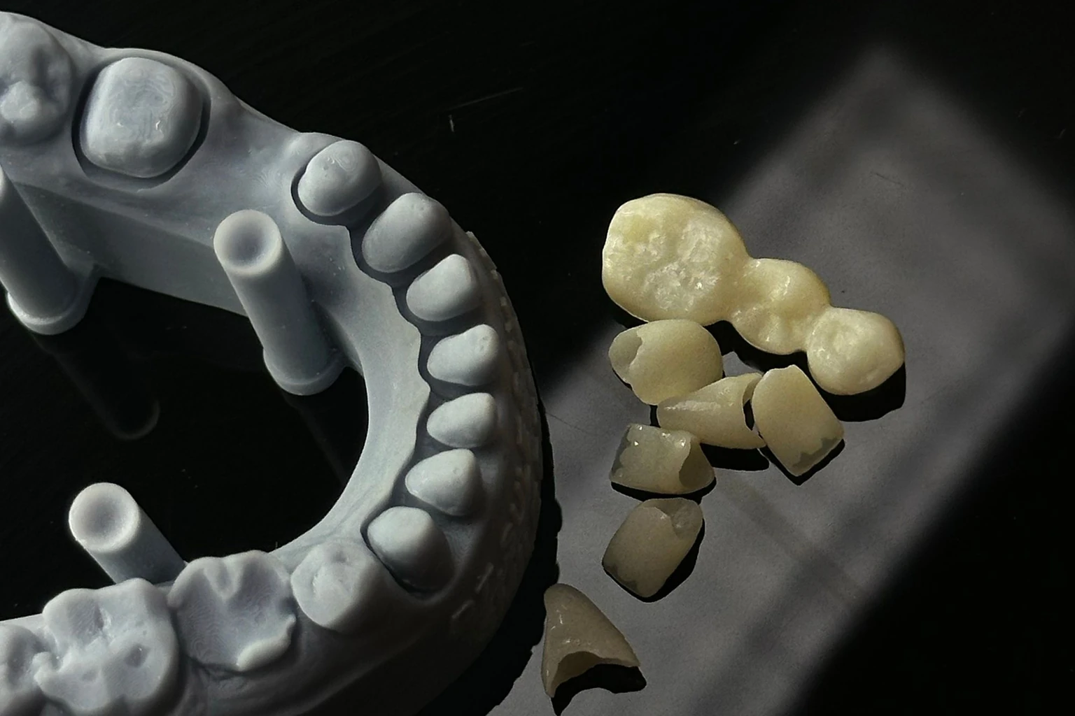 Ceramic dental crowns and a bridge beside a dental lab model, for a crown and bridge failure evidence review