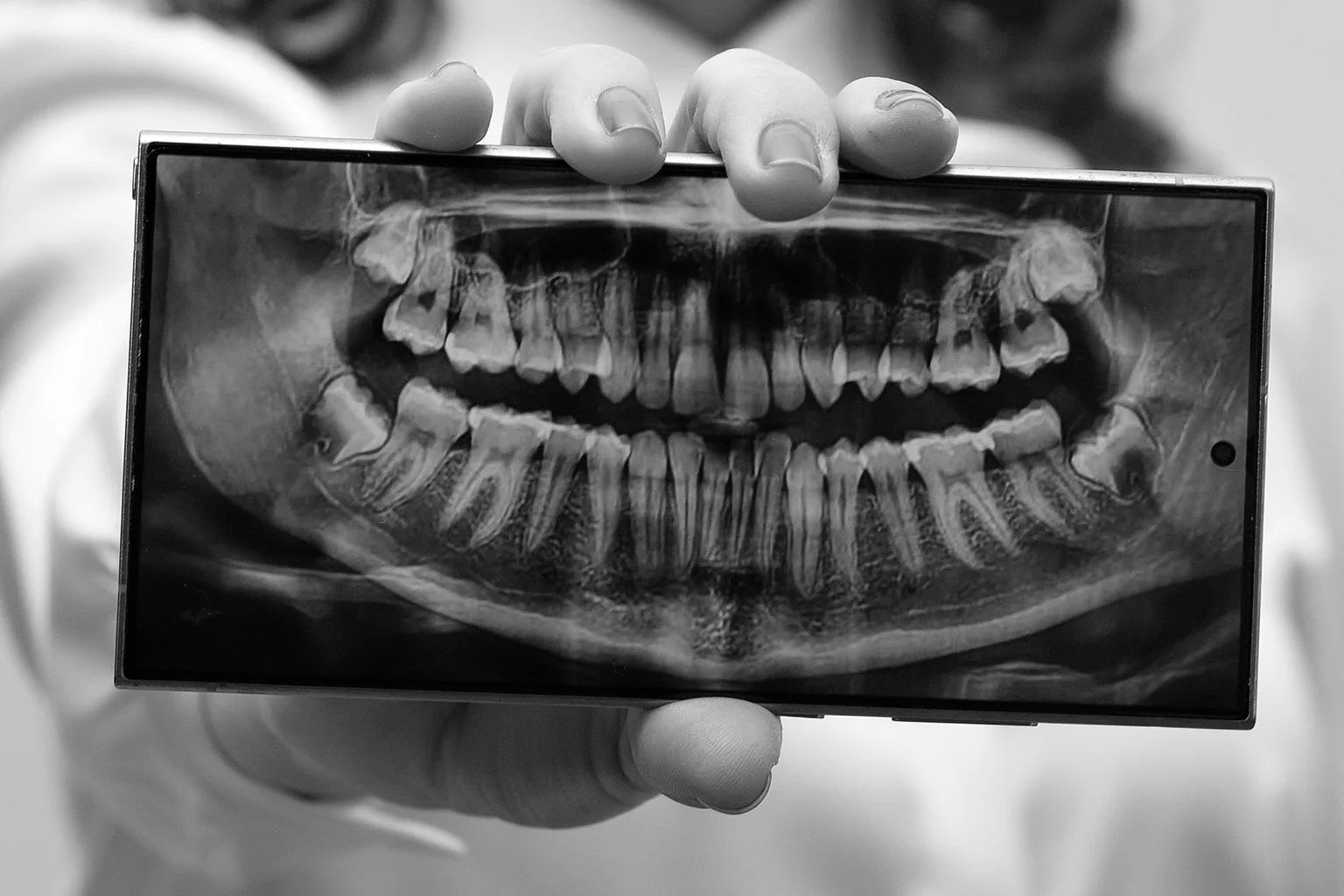 A hand-held device showing a panoramic dental radiograph of the jaw and lower molars, prepared for review