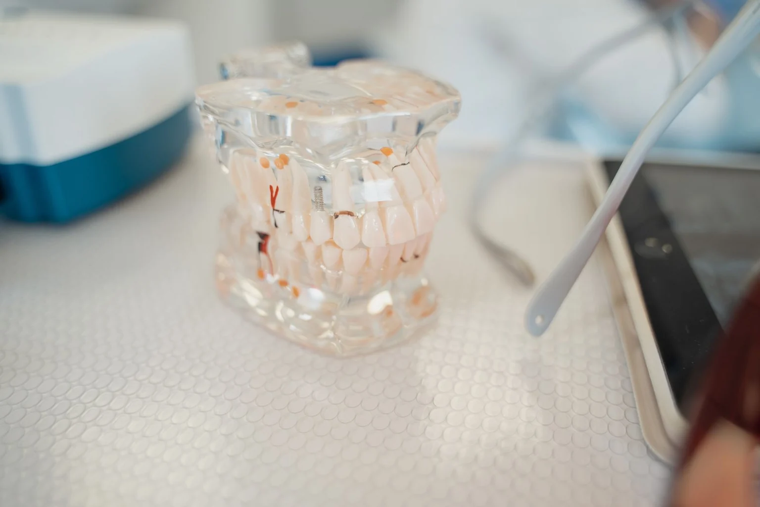 A translucent dental model showing the root canals inside the teeth