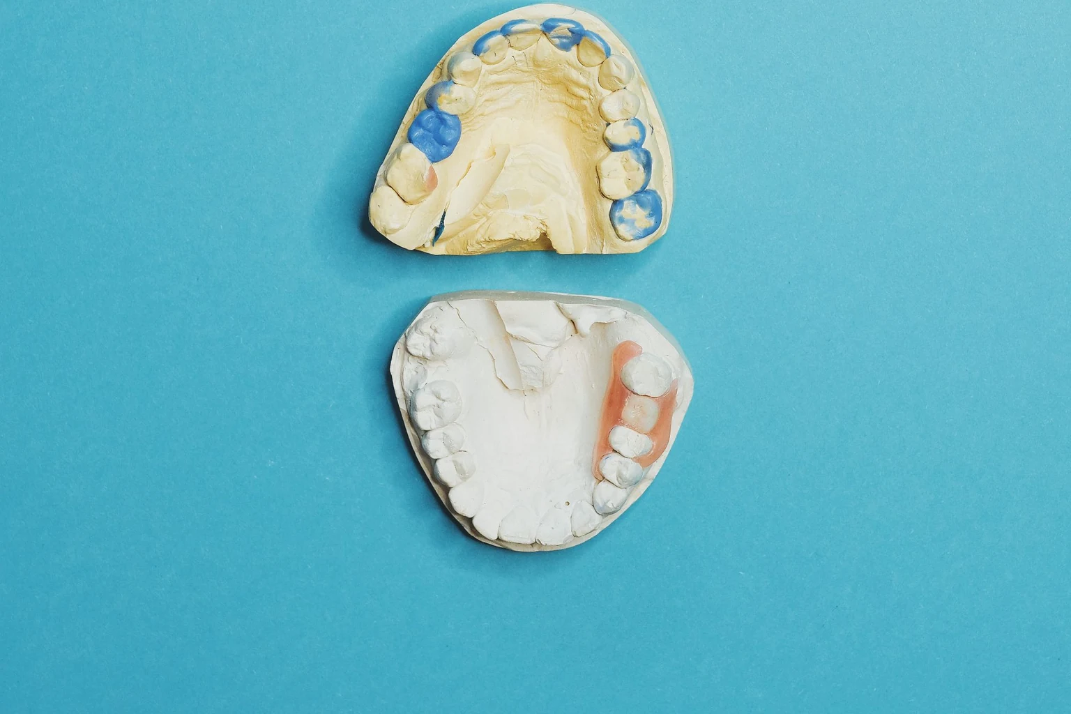 A panoramic radiograph and study model prepared for a dental and facial injury evidence review