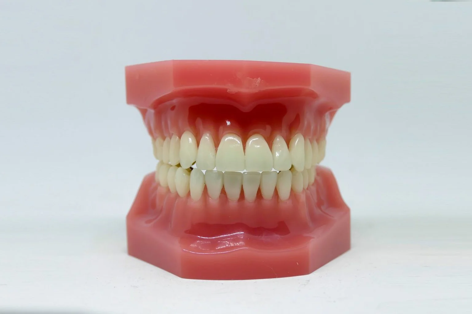 A full dental study model of the upper and lower teeth, representing a general dental course of care