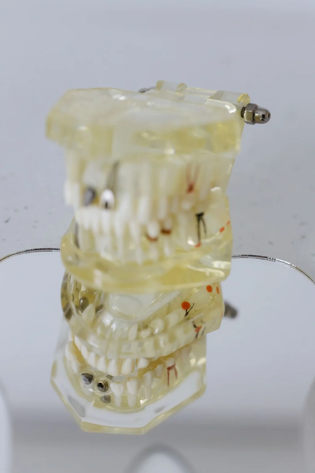 A translucent dental demonstration model of the teeth and jaws, used in independent dental review