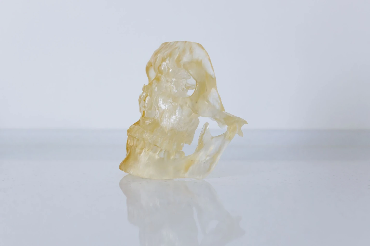 A skull and mandible model at the temporomandibular joint, prepared for a jaw and joint evidence review
