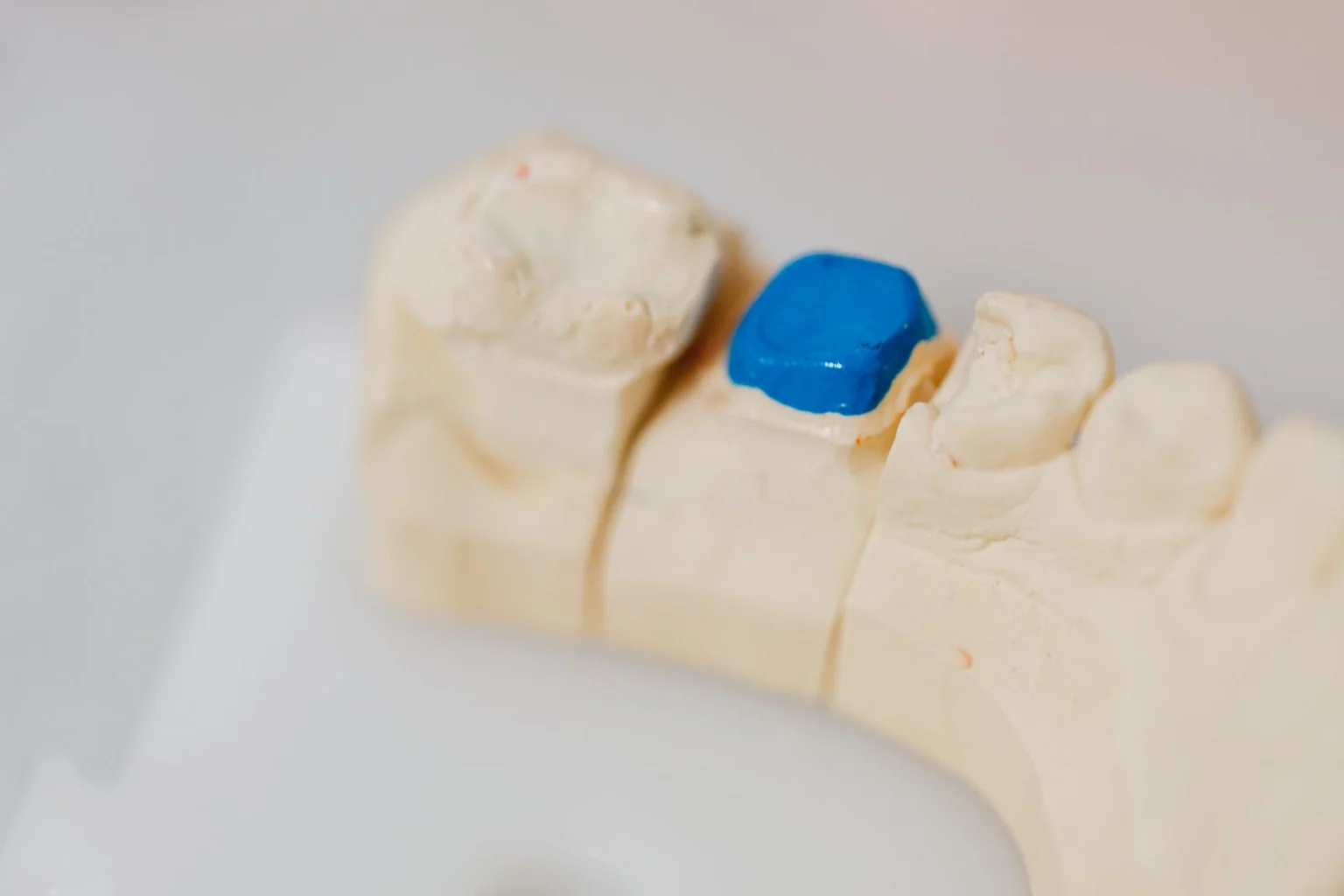 A dental study model used to assess the standard of dental care and the developing dentition