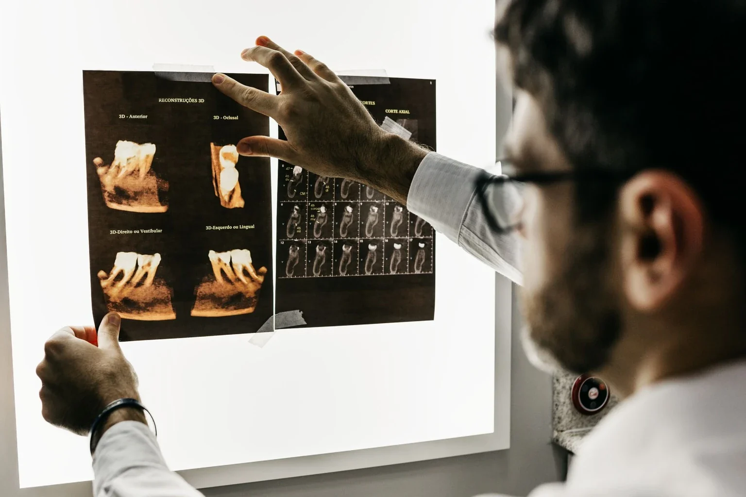 Clinician examining dental radiograph and 3D reconstruction films on an illuminated panel during an early case review